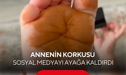 Sabah uyandığında çocuğunu böyle görünce korktu! Gerçek bambaşka çıktı