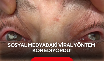 Gözüne sadece 2 damla damlatmıştı... Viral yöntem kör ediyordu!