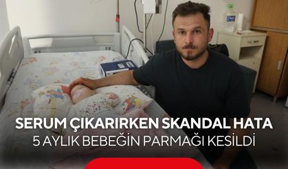 Devlet Hastanesinde korkunç ihmal! Hemşire 5 aylık bebeğin parmağını kesti