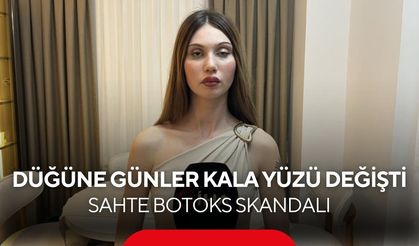 Sahte Doktor Dehşeti: Düğün Öncesi Botoks Kabusa Döndü