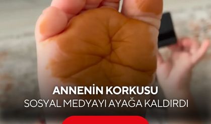 Sabah uyandığında çocuğunu böyle görünce korktu! Gerçek bambaşka çıktı