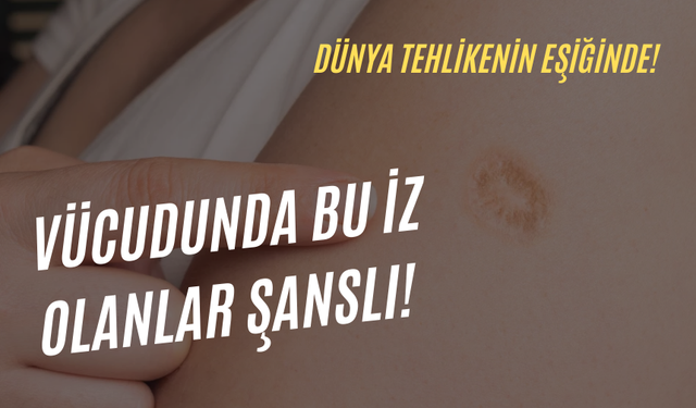 Vücudunda bu iz olanlar şanslı! Yeni virüsten koruma oranını Bakan açıkladı