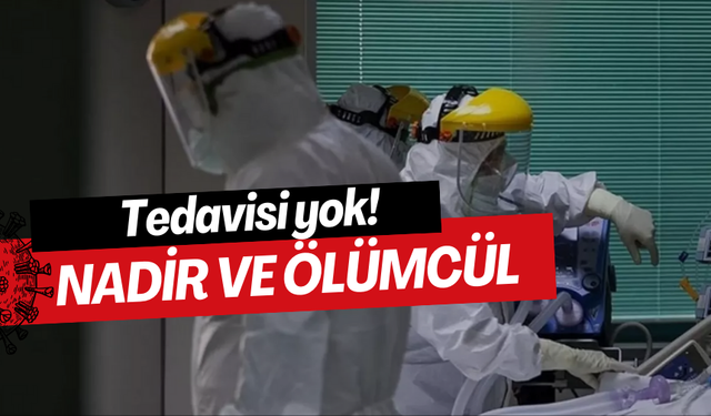 ABD ilk vakayı tedavisi yok diyerek duyurdu! 'Nadir ve Ölümcül' alarmı...