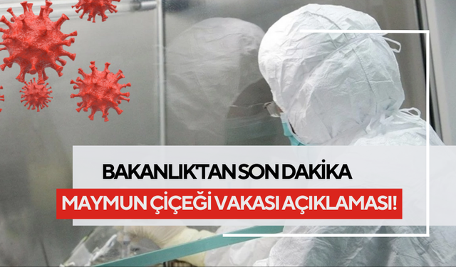 Bakanlık'tan son dakika maymun çiçeği vakası açıklaması! Kısıtlama gelecek mi?