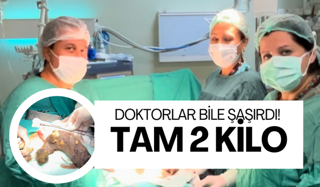 Doktorlar bile şaşırdı! Genç kızın karnından 2 kilogram kıl yumağı çıktı