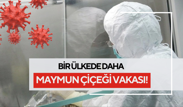 Dünya diken üstünde | Bir ülkede daha maymun çiçeği vakası!