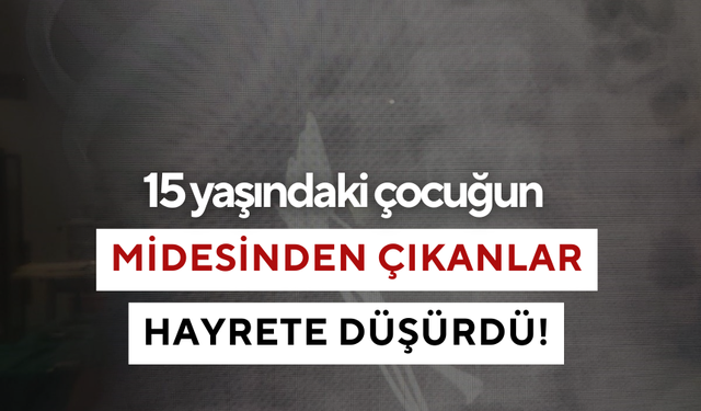 15 yaşındaki çocuğun midesinden çıkanlar hayrete düşürdü!