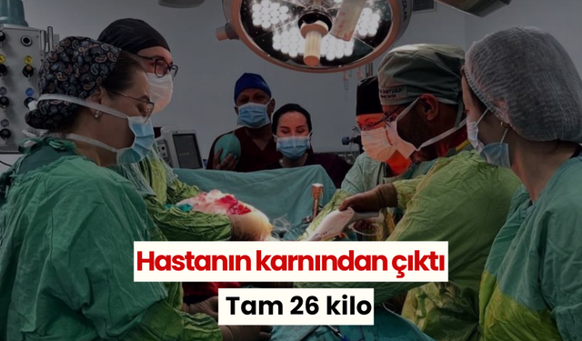 Hastanın karnından çıktı tam 26 kilo