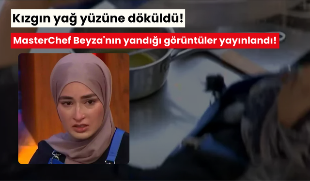 Kızgın yağ yüzüne döküldü! MasterChef Beyza'nın yandığı görüntüler yayınlandı! Acılar içinde kıvrandı...