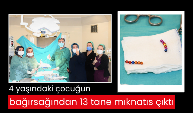 4 yaşındaki çocuğun bağırsağından 13 tane mıknatıs çıktı