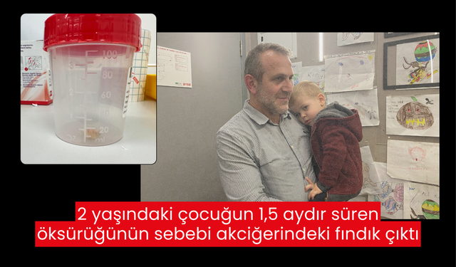 2 yaşındaki çocuk 1,5 aydır öksürük nöbeti geçiriyordu, sebebi akciğerindeki fındık çıktı