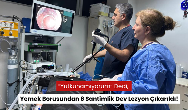 Yutkunma güçlüğüyle gitti, yemek borusundan 6 santimlik dev lezyon çıkarıldı!