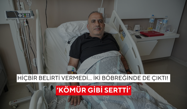 Hiçbir belirti vermedi… İki böbreğinde de çıktı! ‘Kömür gibi sertti’
