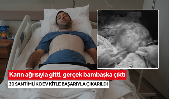 Karın ağrısıyla gitti! 43 yaşındaki adamın karnından 30 santimlik dev kitle çıkarıldı