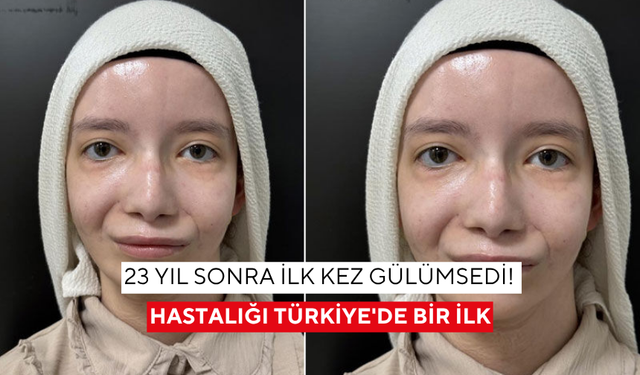 23 yıl sonra ilk kez gülümsedi! Hastalığı Türkiye'de bir ilk