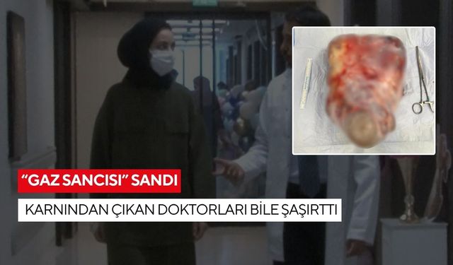 24 yaşındaki kadının karın ağrısının altından bakın ne çıktı? Doktorlar bile şaşırdı!
