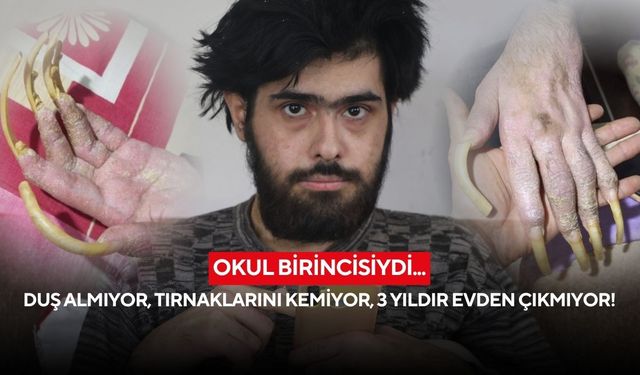 Üç yıldır ne dışarı çıktı ne de banyo yaptı: “Öleceğim” diyen 23 yaşındaki genç, hayattan umudunu kesti