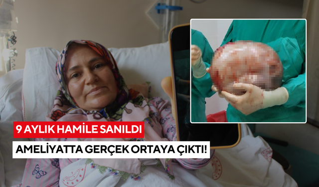 Doktorlar bile şaşırdı! Kadının karnından karpuz kadar kitle çıktı
