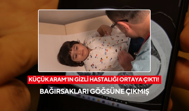 Küçük Aram’ın gizli hastalığı ortaya çıktı! Bağırsakları göğsüne çıkmış