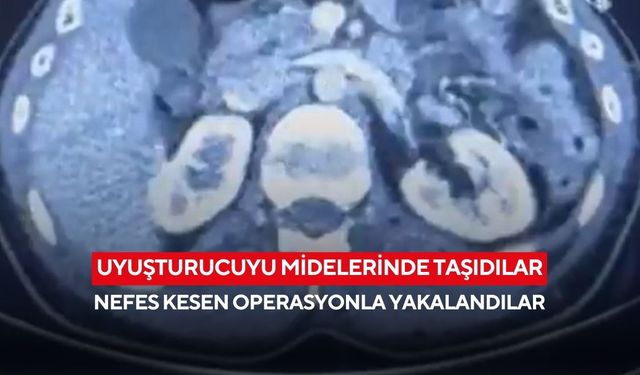 Uyuşturucuyu midelerinde taşıdılar: Nefes kesen operasyonla yakalandılar