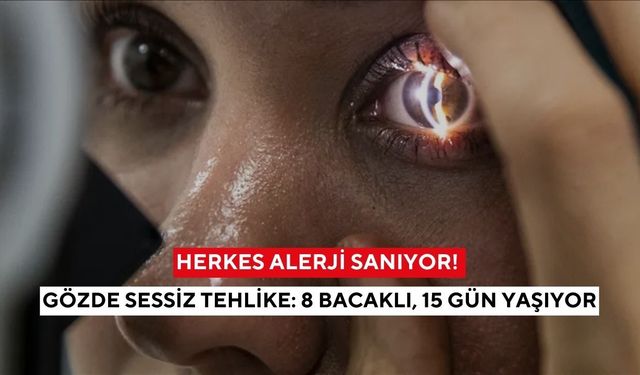 Batma, kaşıntı, kızarıklık… Nedeni alerji değil, gözdeki görünmez parazit