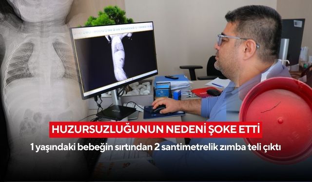 Bebeğin huzursuzluğunun nedeni şoke etti: Akciğere ilerleyen zımba teli