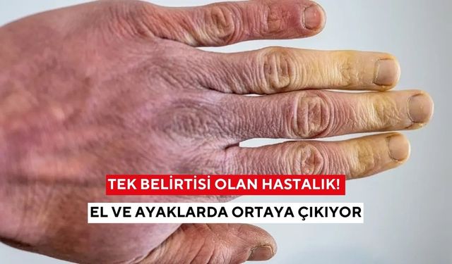 Genç kadınlarda daha sık görülüyor! El ve ayaklarda renk değişimi bu hastalığın habercisi