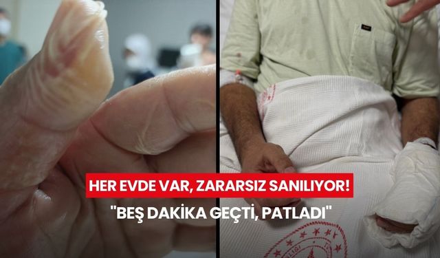 Her evde var, zararsız sanılıyor! Vücudunun yüzde 30’u yandı