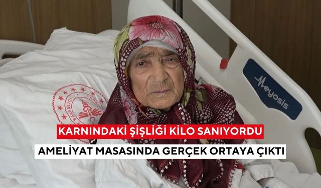 Karnındaki şişliği kilo sanıyordu: Ameliyat masasında gerçek ortaya çıktı