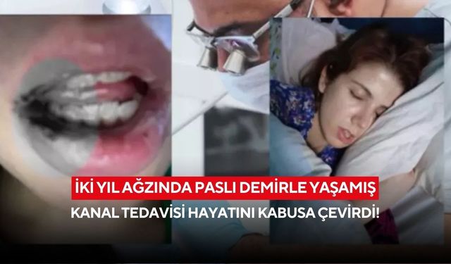 “Ölebilirdim” dedi: Kanal tedavisinde şoke eden ihmal iddiası