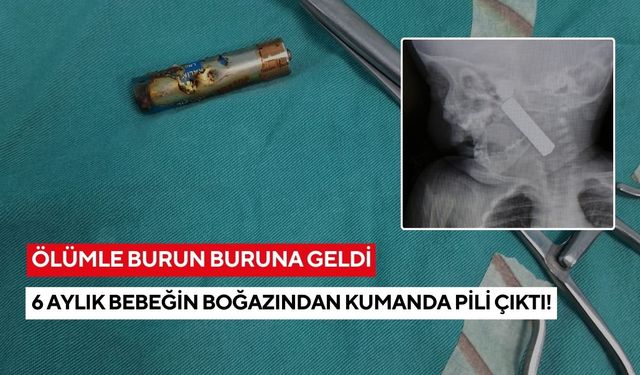 Ölümle burun buruna geldi: 6 aylık bebeğin boğazından kumanda pili çıktı!
