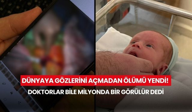 Dünyaya gözlerini açmadan ölümü yendi! Doktorlar bile milyonda bir görülür dedi