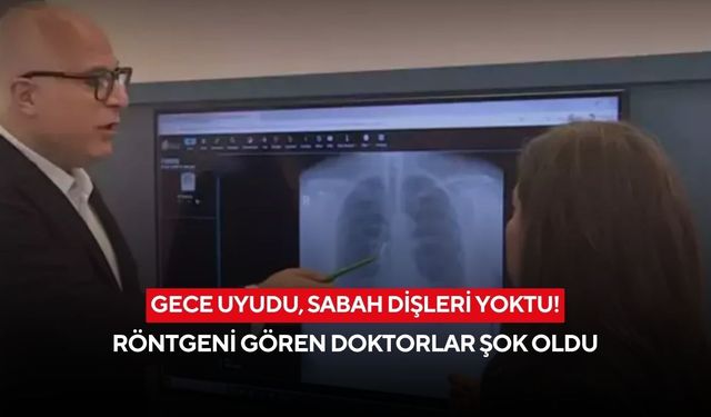 Gece uyudu, sabah dişleri yoktu! Doktorların gördüğü gerçek akıllara durgunluk verdi