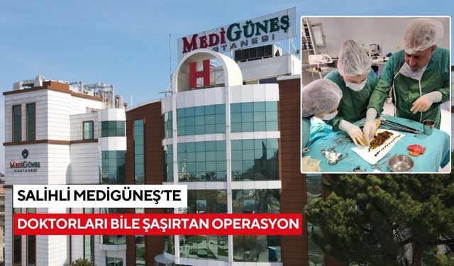 Kendisi bile şaşırdı: Safra kesesi değil sanki taş ocağı!