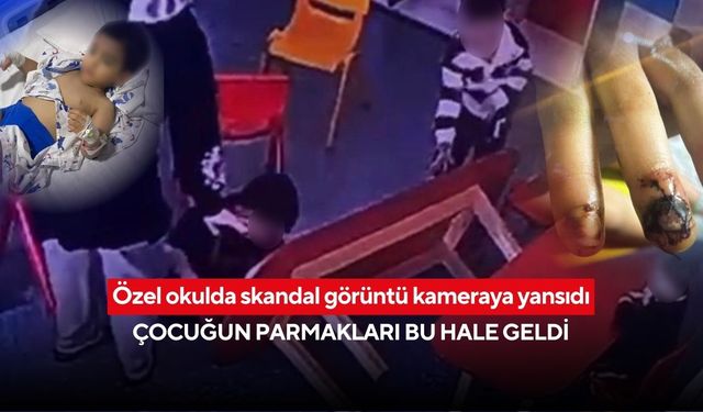 Okulda korkunç ihmal: Devrilen masa küçük çocuğun parmaklarını ezdi