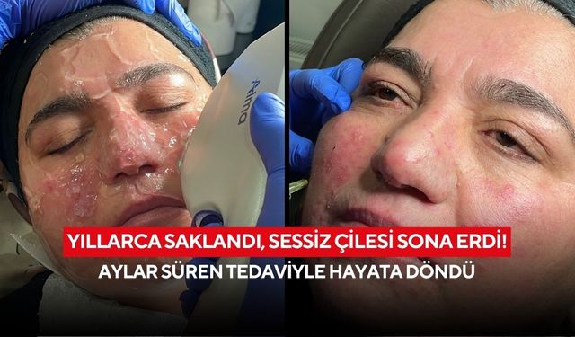 Yıllarca saklandı, sessiz çilesi sona erdi! Aylar süren tedaviyle hayata döndü
