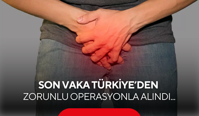 Dünyada 60 vaka var, sonuncusu Türkiye'den: Zorunlu operasyonla alındı...
