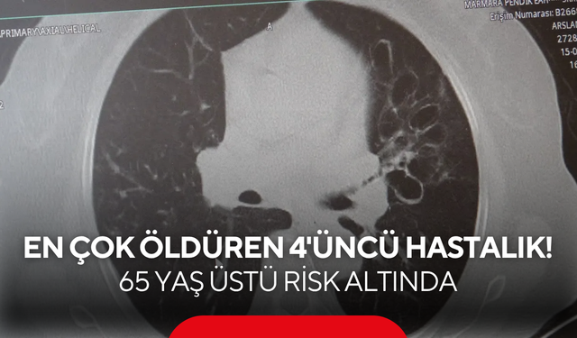 Akciğerleri sinsice yok ediyor! Dünyada en çok öldüren 4. hastalık...