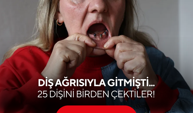 Diş ağrısıyla gitti, ağzında diş kalmadı!