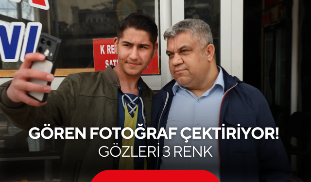 Gören fotoğraf çektiriyor! Gözleri tam 3 renk: ''Annem duasında demiş''