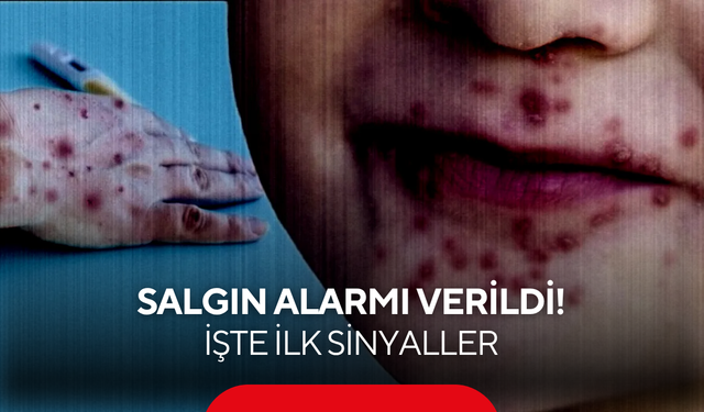 Kreş ve anaokullarında hızla yayılıyor: Bu yıl beklenenden erken başladı