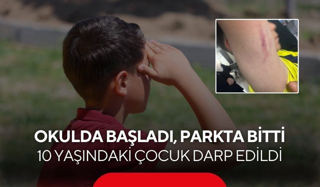 İlkokul öğrencilerinin tartışmasında anne 10 yaşındaki çocuğu darp etti