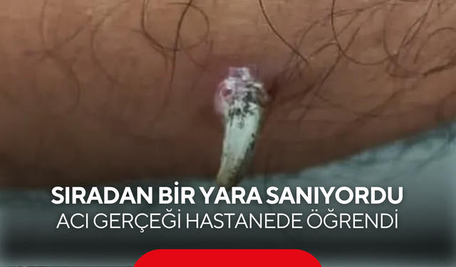 Sıradan bir yara sanıyordu, acı gerçeği hastanede öğrendi