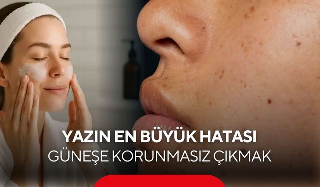 Uzmandan Yaz Uyarısı! Güneş, Deniz ve Klor Cilt ve Saçı Sessizce Yıpratıyor