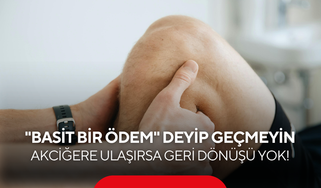 Bacak şişliği ve nefes darlığı… "Basit bir ödem" deyip geçmeyin! Nedeni hayati olabilir