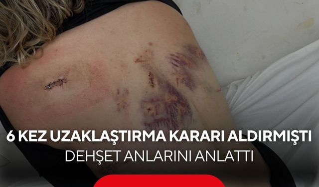 Bıçaklı saldırıya uğrayan kadın yaşadıklarını anlattı... "Bıçak kırılmasaydı yaşayamazdım"