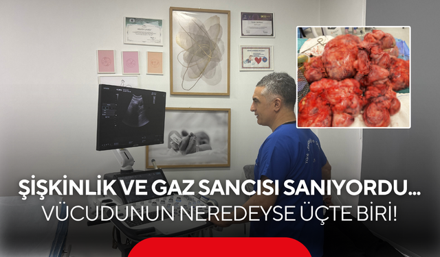 Doktorlar bile görünce şaşırdı... Çapı itibarıyla dünyanın en büyük vakalarından biri olabilir