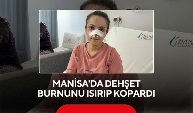 Manisa'da dehşet! Burnu ısırılarak koparılan kadın: Canımın acısıyla balkondan atlamayı düşündüm