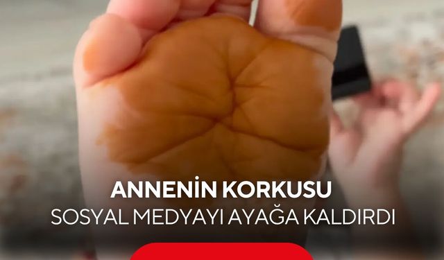 Sabah uyandığında çocuğunu böyle görünce korktu! Gerçek bambaşka çıktı