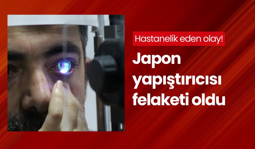 Sol gözüne Japon yapıştırıcısı kaçan genç hastanelik oldu!